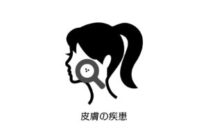 hifu